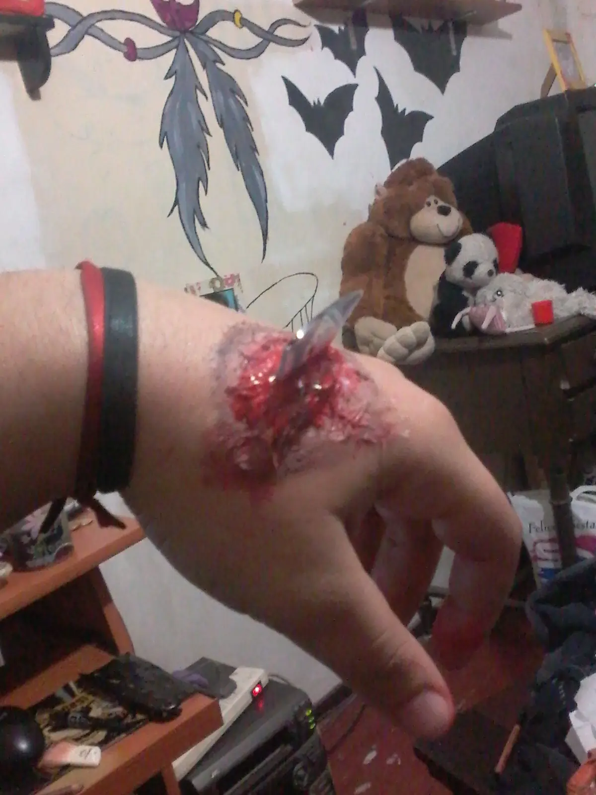 heridas