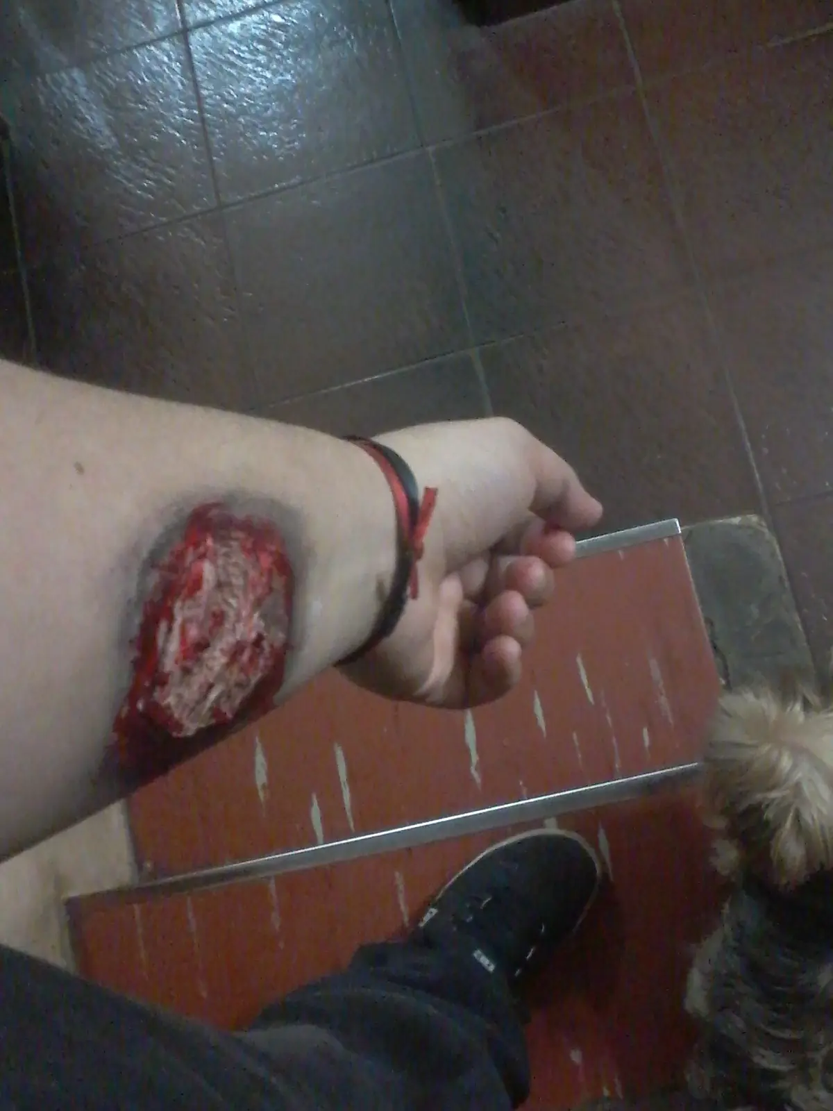heridas