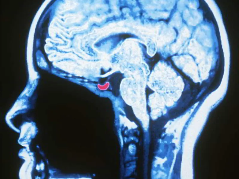 Esto es lo que pasa a tu cuerpo cuando te emborrachas