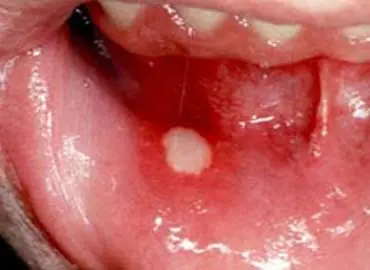 Enfermedades varias... cuidemos nuestra salud