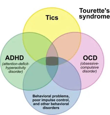Tourette Tourette