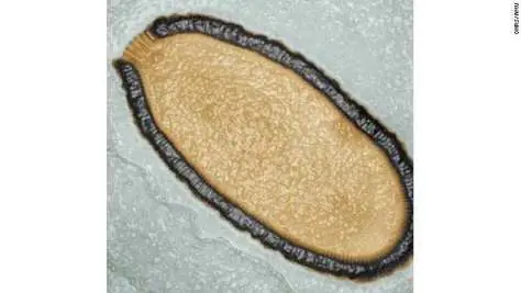 Virus gigante de 30 mil años de edad vuelve a la vida