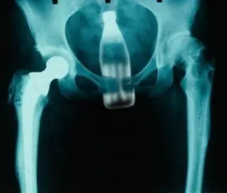 dentro de un cuerpo