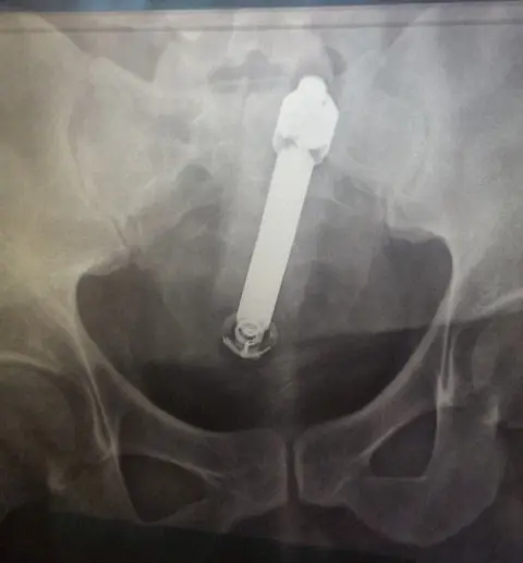 dentro de un cuerpo