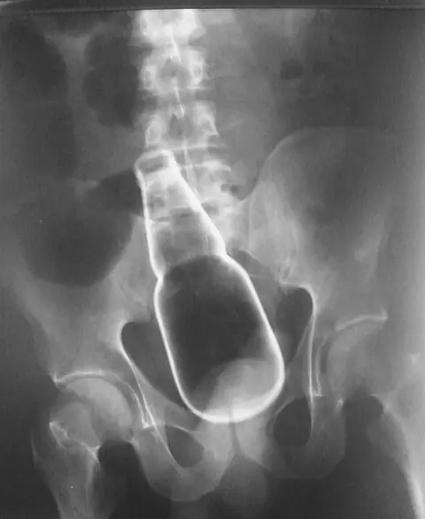 dentro de un cuerpo