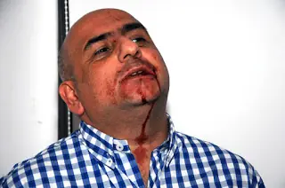 abuso