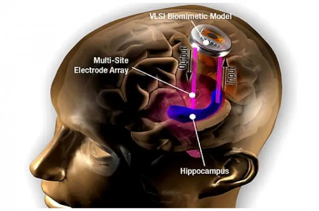 cerebro superdotado