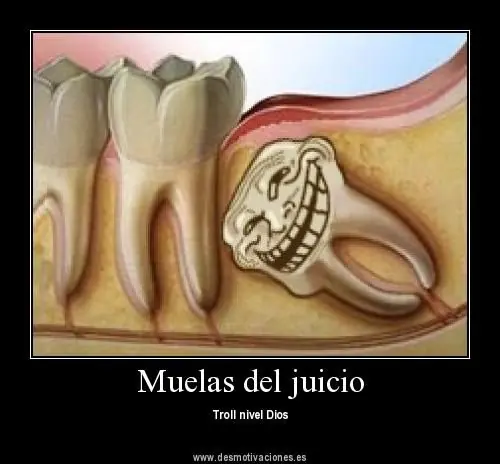 partes