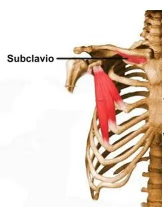 infuncional