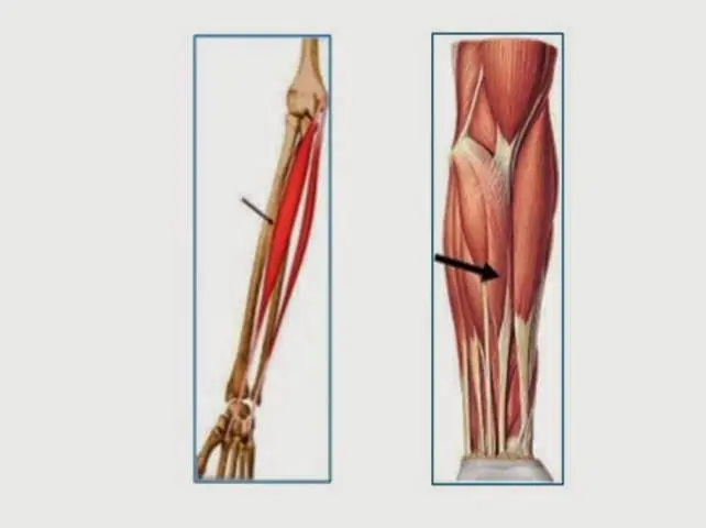 20 partes del cuerpo innecesarias