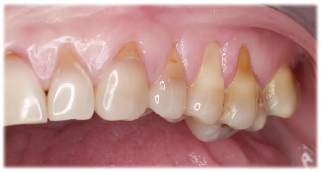 ¿Mal aliento? Yo te ayudo (Dentista) mega-post