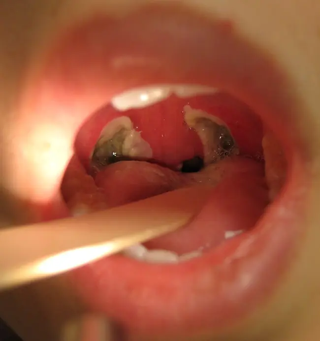 ¿Mal aliento? Yo te ayudo (Dentista) mega-post