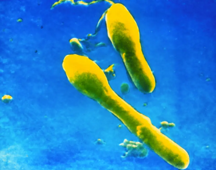 NEUROTOXINAS