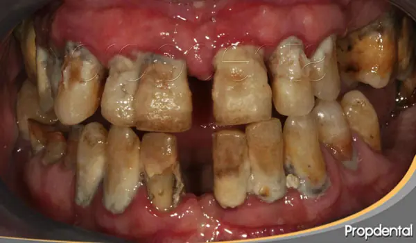 ¿Mal aliento? Yo te ayudo (Dentista) mega-post
