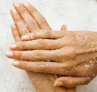 Hielo