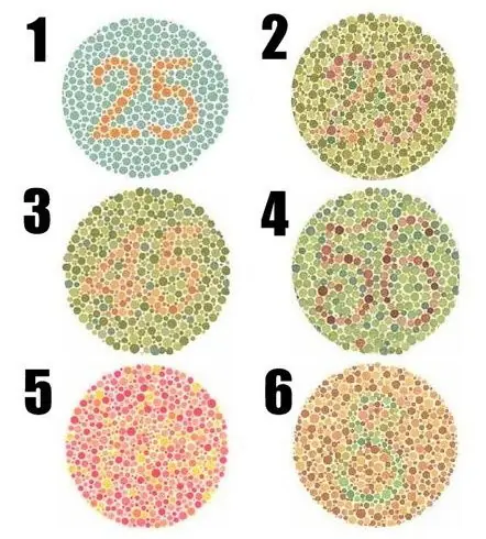 ¿Tenes alguna enfermedad mental? Enterate aquí lince.