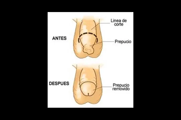 pene