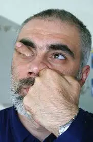 -