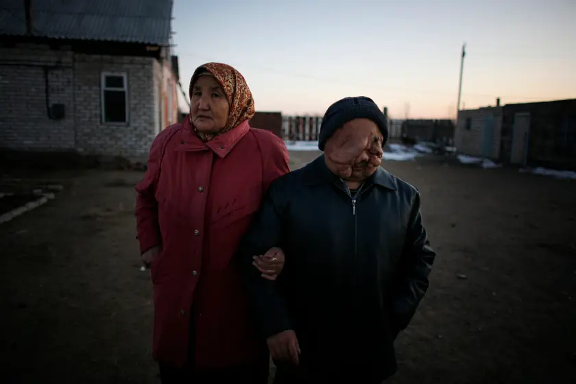 El rostro actual de la tragedia nuclear de Chernobyl