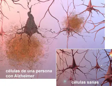 NEUROCIENCIA