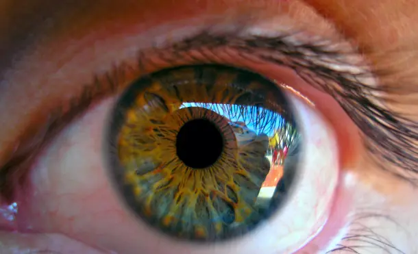 Vision