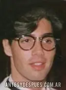 Ricardo Fort antes y despues