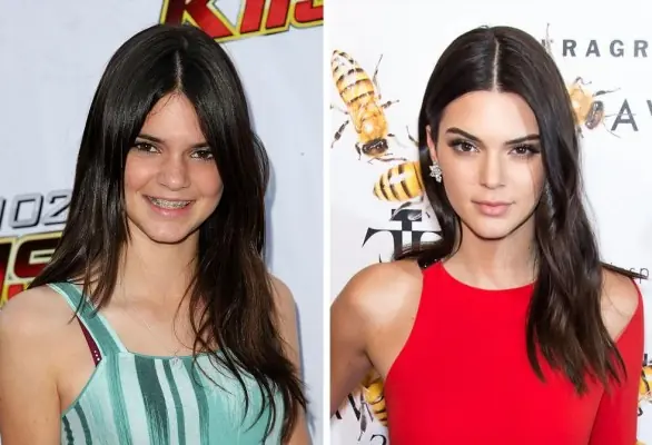 Los cambios de Kyle Jenner