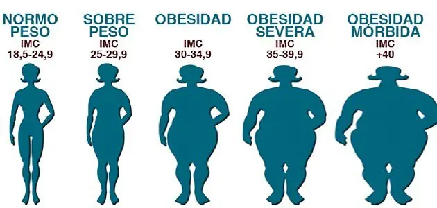 obesidad