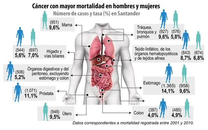 Cancer de mama