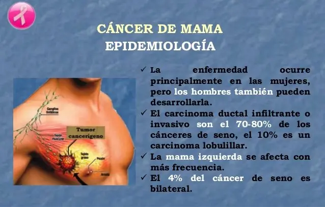 Cáncer de mamá en Hombres, Cosas importantes que debes Saber