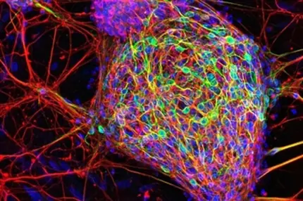 cerebro humano