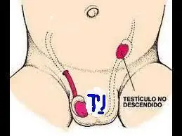 tetasdeaguila