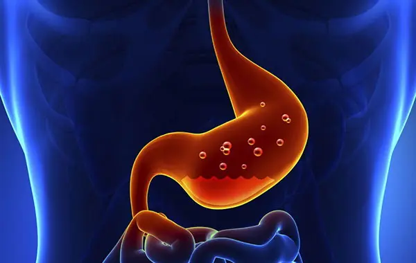 Cura Natural para las Úlceras, Gastritis y Gastritis Crónica