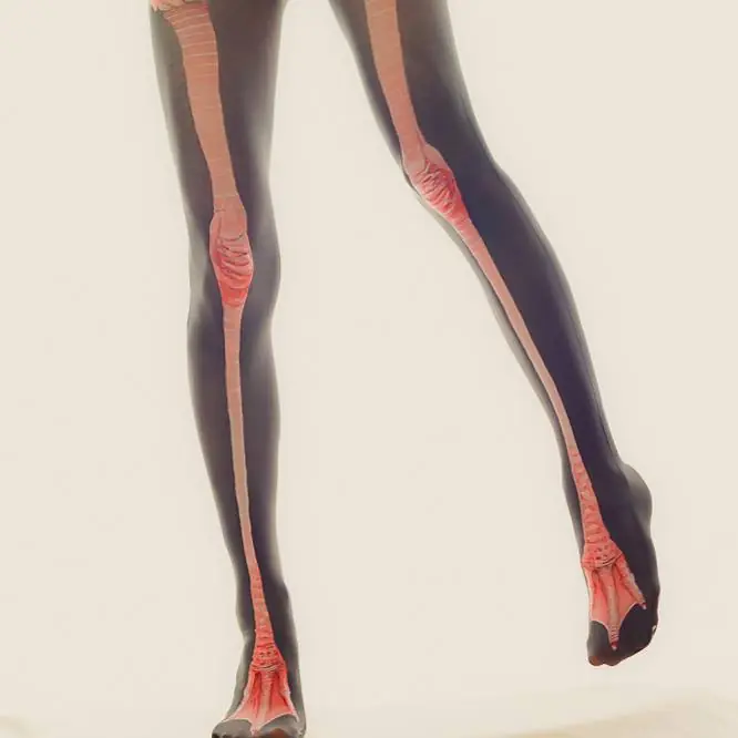 body