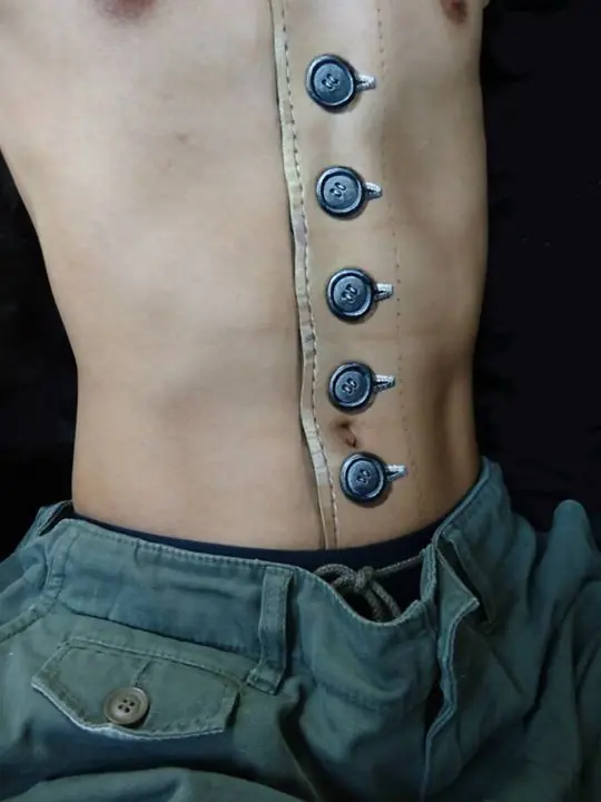 body