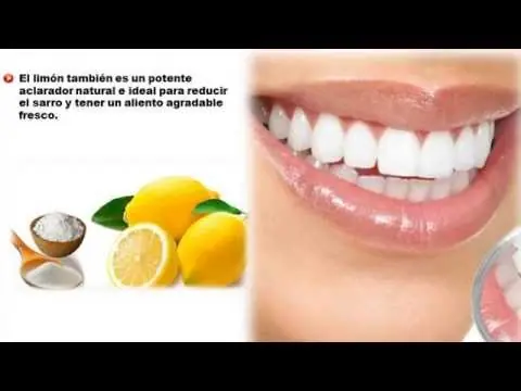 blanquear dientes