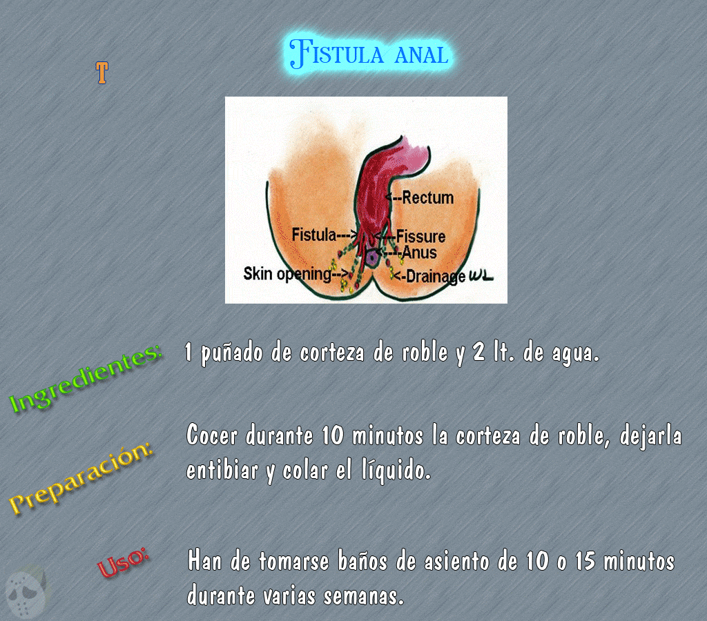 troesma lince maquinola
