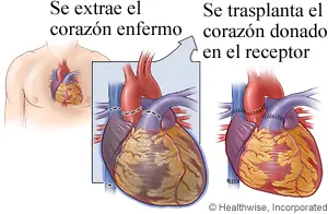corazon