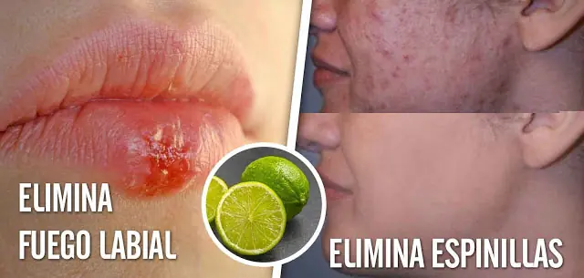 8 enfermedades de la piel que el limón puede curar