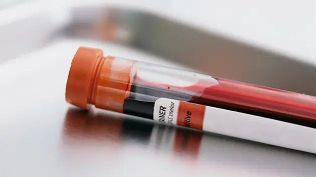 Nuestra 'fecha de caducidad' en una gota de sangre