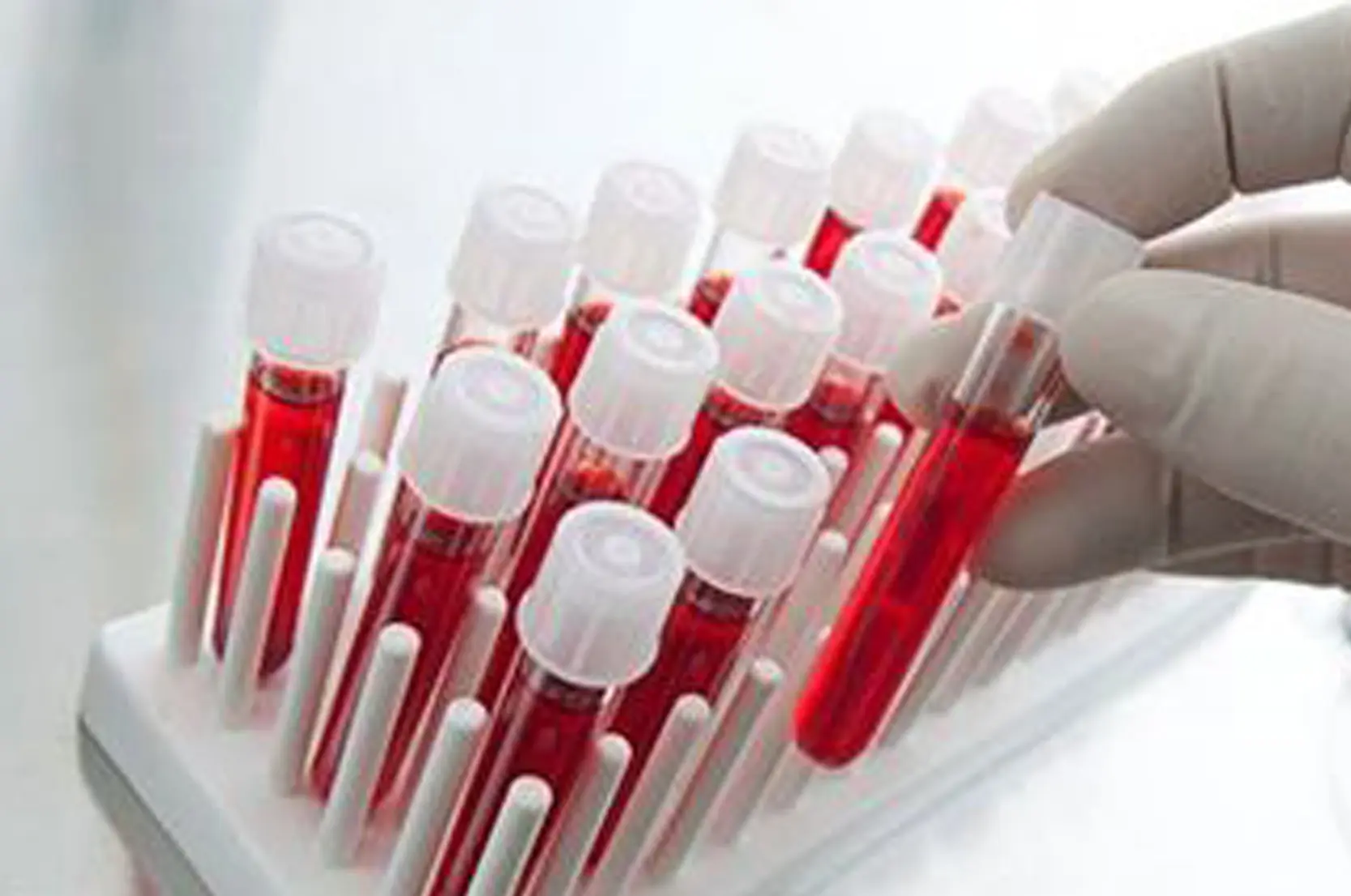 Como verificar los resultados de tus analisis de sangre