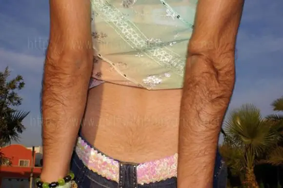 fotos