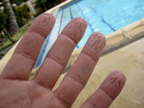 Por qué se arrugan los dedos en el agua
