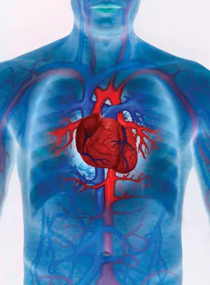 sinusitis