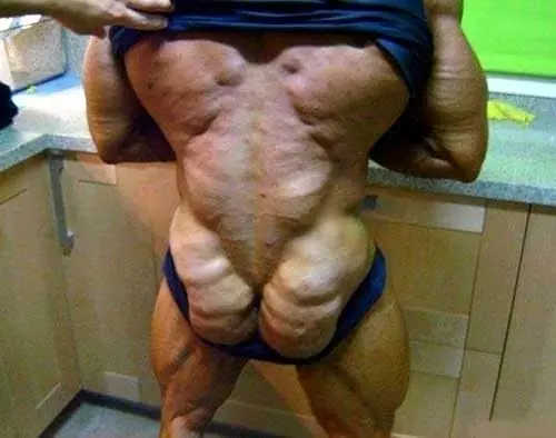 Lo que pasa por consumir esteroides en exceso