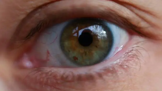 Vision