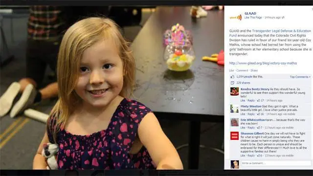 sindrome de klinefelter