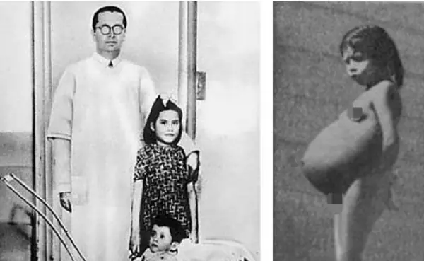 Fue mama a los 5 años y te lo cuento