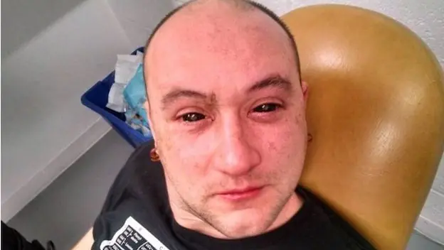 Ojos
