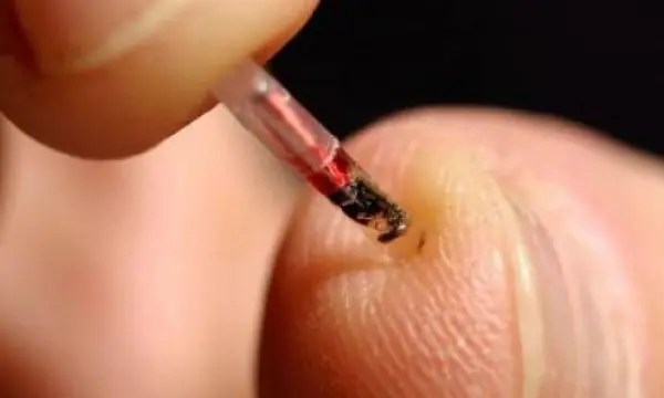 Conoce lo que podrías hacer con un chip implantado en tu cu
